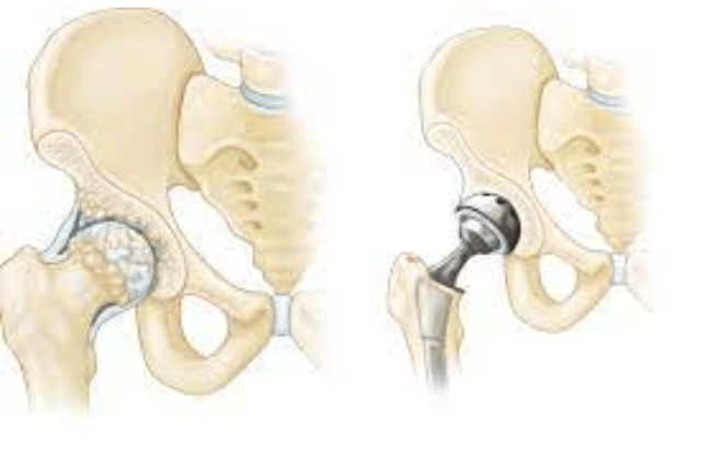 best knee surgeon in pune
