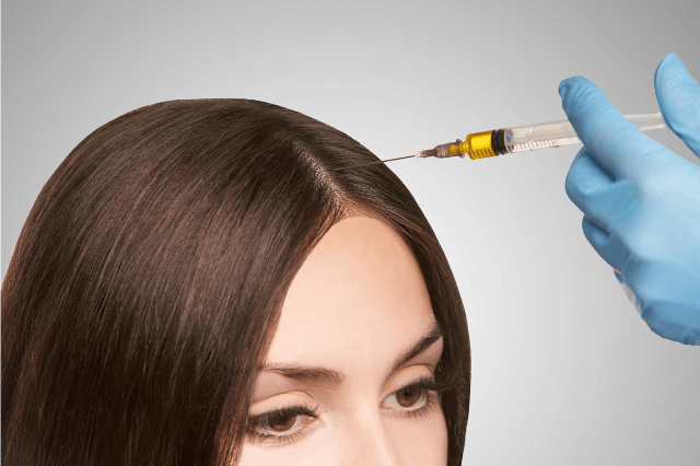best doctor in pune for hair loss treatment,